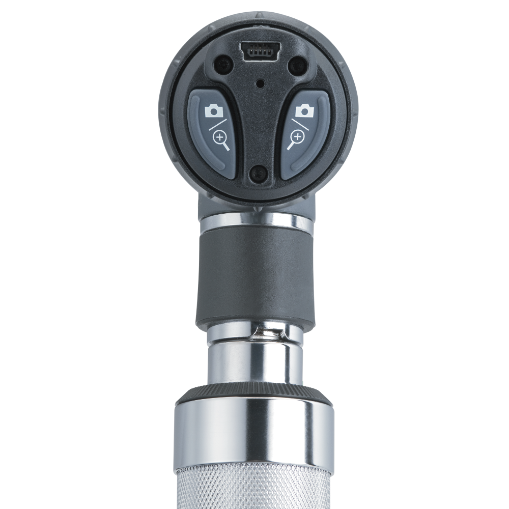 WA23920 Otoscopio digital MacroView USB - Imagen 2